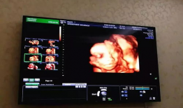 四维视频,四维视频揭秘未知世界